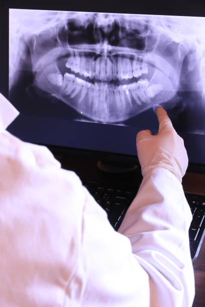 Best Emergency Root Canal Treatment in Black Diamond, WA